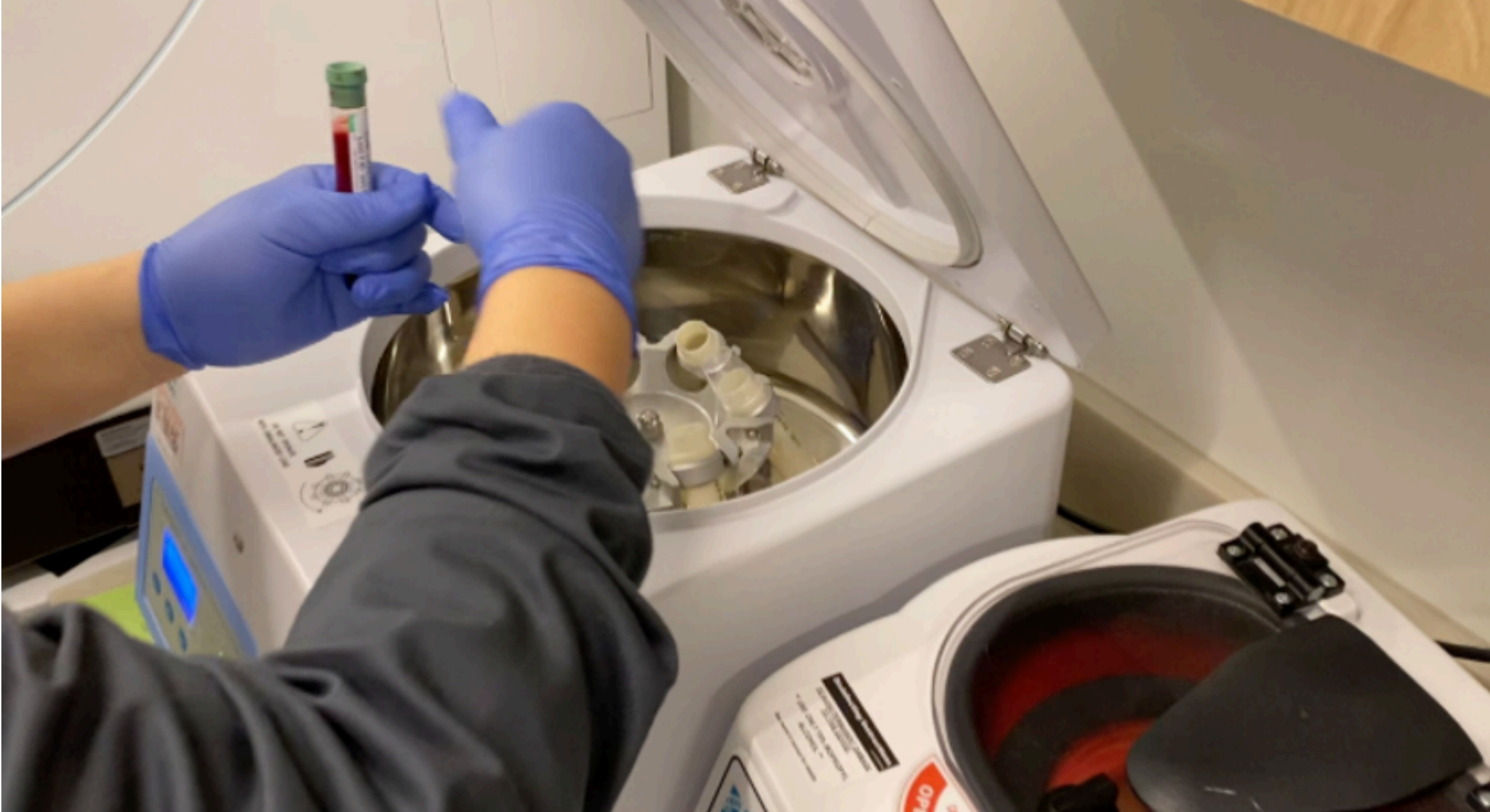 准父母查看捐卵资料